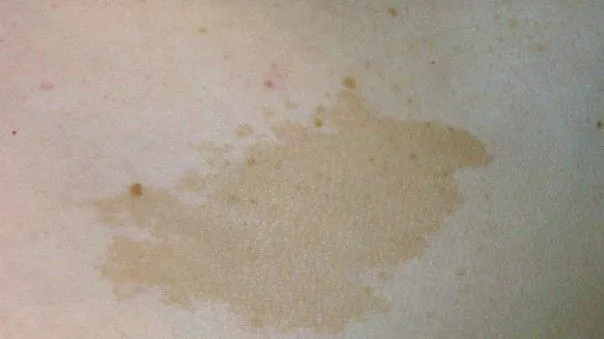 Café-au-lait