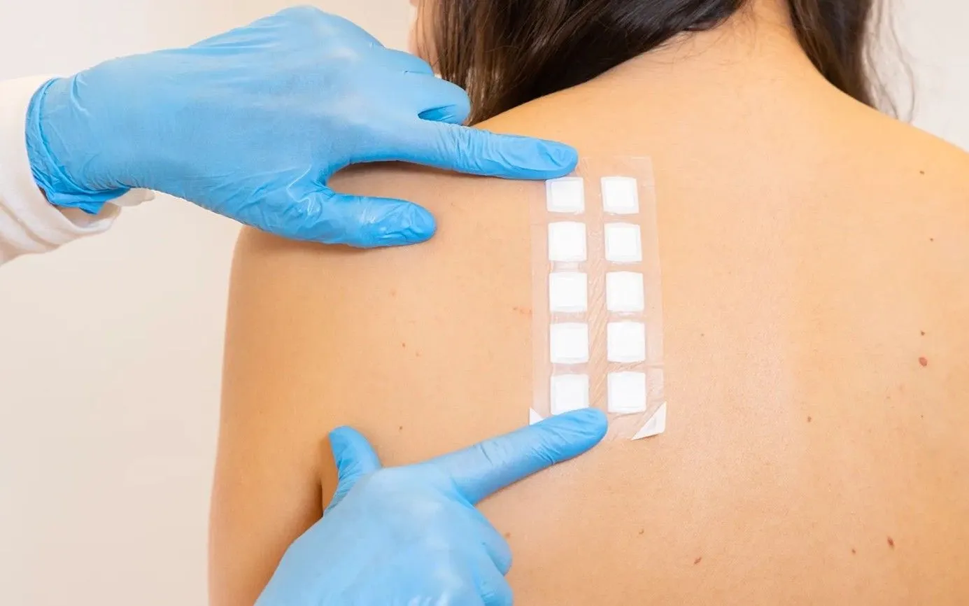 Patch-tests et interprétation